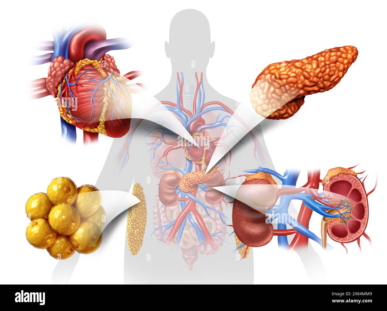 Metabolic Disorder